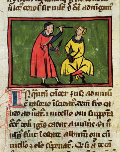 Ms H 89 Tratamiento quirúrgico, de una edición del Libro de Cirugía por Rogier de Salerne de French School