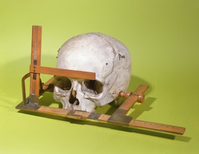 Cráneo en un goniómetro facial construido por Paul Broca de French School