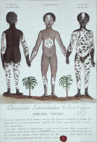 El fenómeno del vitíligo de French School