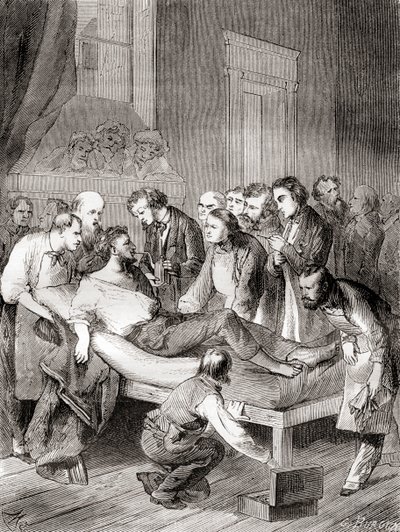 La primera demostración pública del uso de éter inhalado como anestésico quirúrgico en 1846 por un dentista estadounidense, William Thomas Green Morton, de 