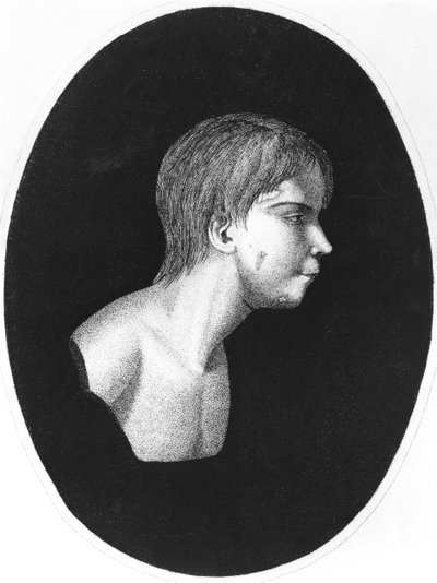 Víctor de Aveyron, frontispicio de De l