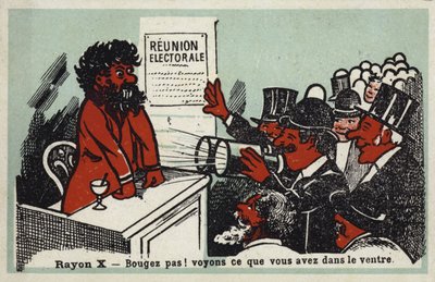 Rayos X - ¡No te muevas! Veamos qué tiene en el estómago de French School