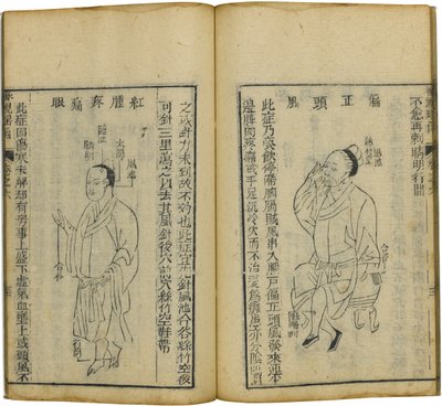 Shen Shi Yao Han Un libro precioso de oftalmología, 1644 de Fu Renyu