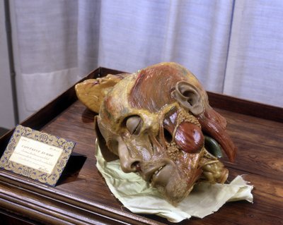 Imagen desconocida de Gaetano Giulio Zumbo