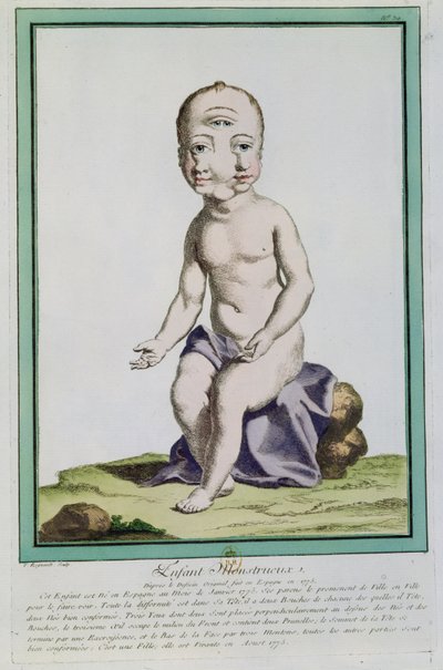 Niño con Cabeza Deformada, de 