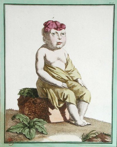 Niño con media cabeza, de 