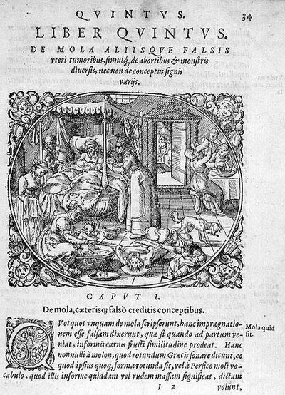 Después del nacimiento, ilustración del capítulo 1, Libro 5 de 