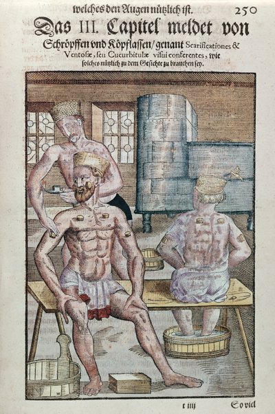 Ventosas, de Ophthalmodouleia por Georg Bartisch (1535-1636) publicado en Dresde en 1583 de German School