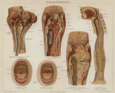 Enfermedades de la garganta de German School