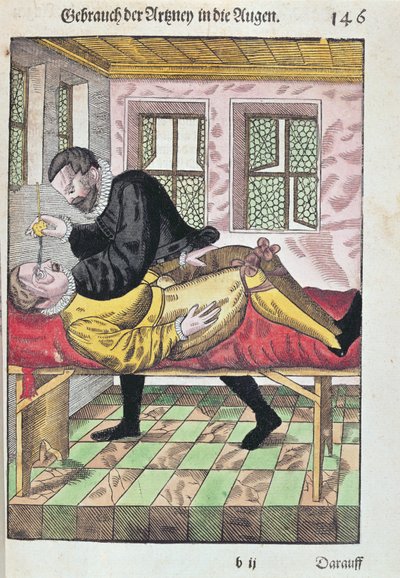 Operación de Ojo, de Ophthalmodouleia por Georg Bartisch (1535-1636) publicado en Dresde en 1583 (xilografía en color) de German School