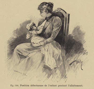 Posición incorrecta de un bebé durante la lactancia de German School