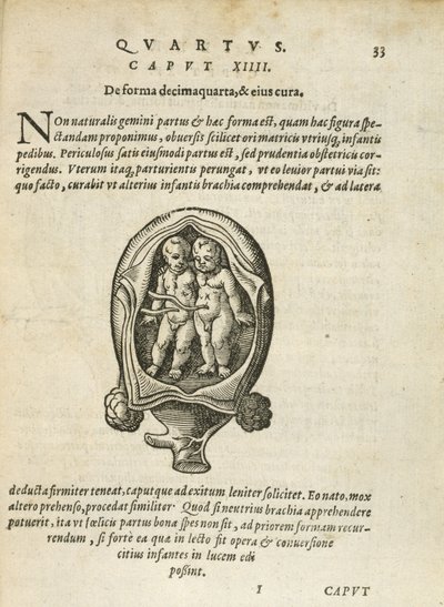 Gemelos no idénticos en el útero, ilustración del capítulo 14, Libro 4 de Sobre la Concepción y el Crecimiento del Hombre por Rueff, 1587 de German School