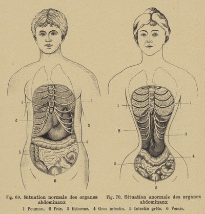 Situación normal de los órganos internos del abdomen en hombres y mujeres de German School