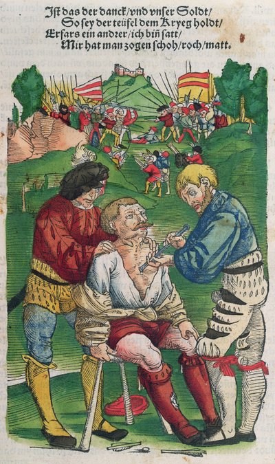 Extracción de una flecha, ilustración de Feldtbuch der Wundartzney por Hans von Gersdorff, 1540 de German School