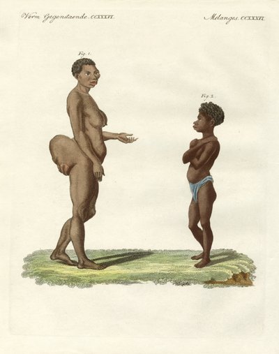 Variedades humanas extrañas de German School