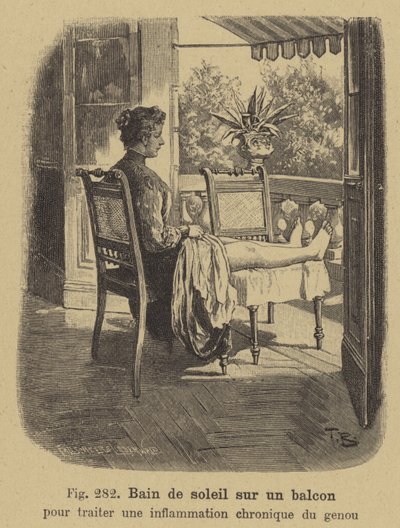 Tomando el sol en un balcón para tratar la inflamación crónica de la rodilla de German School