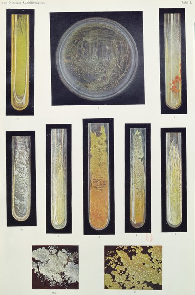 Bacilo de la sífilis, de un libro por Max von Niessen, Leipzig, 1908 de German School