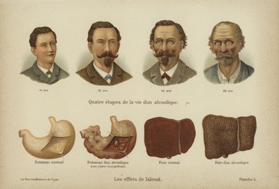 Los efectos del abuso del alcohol de German School