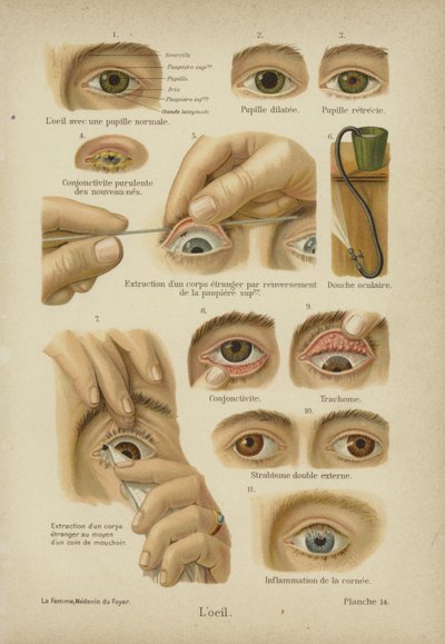 El ojo de German School