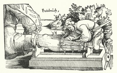 Tratando una pierna fracturada de German School
