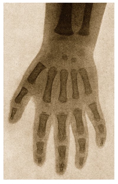 Radiografía de la mano de un niño c.1890 de German School