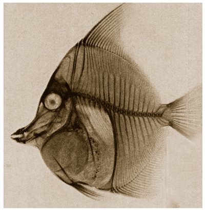 Radiografía de un pez c.1890 de German School