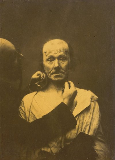 Atención,1854-1856, impreso 1862 (foto) de Guillaume-Benjamin-Armand Duchenne de Boulogne