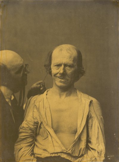Una cara relajada (izquierda); Alegría o risa falsa (derecha) de Guillaume Benjamin Amant Duchenne