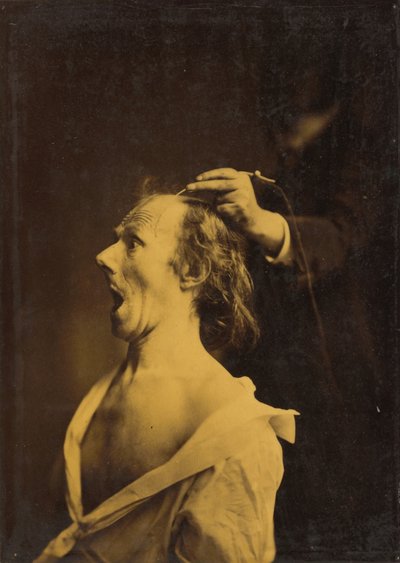 Asombro, estupefacción, asombro de Guillaume Benjamin Amant Duchenne