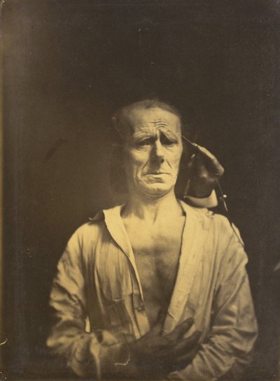 Espasmo del m. corrugador del ceño bajo luz muy fuerte (izquierda); Una cara relajada (fotografiada a plena luz del sol) (derecha) de Guillaume Benjamin Amant Duchenne