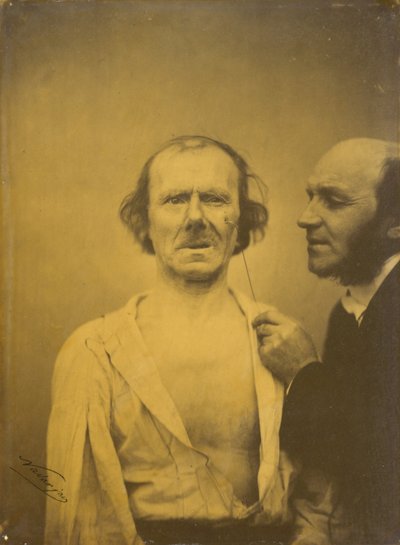Llorando, lágrimas de piedad (izquierda); Rostro relajado (derecha) de Guillaume Benjamin Amant Duchenne