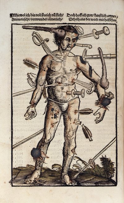 XVIIIv El hombre herido, del 