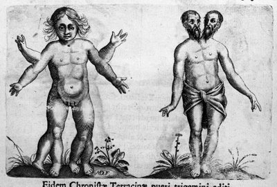 Diferentes tipos de monstruos humanos. Grabado de “De monstrorum natura, causis et differentiis” de Fortunio Liceti (1577-1656), científico italiano. 1646 de Italian School