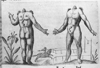 Diferentes tipos de monstruos humanos: un hombre sin cabeza. Grabado de “De monstrorum natura, causis et differentiis” por Fortunio Liceti (1577-1656), científico italiano. 1646 de Italian School