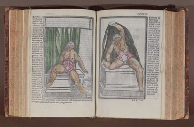 Anatomía femenina, de Commentaria cum amplissimis additionibus super anatomiam mundini, por Jacopo Berengario da Carpi (c.1460-c.1530) publicado en Bolonia, 1521 de Italian School