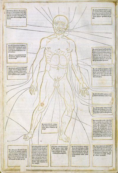 Ilustración de "Fasciculus medicinae" Venecia de Italian School