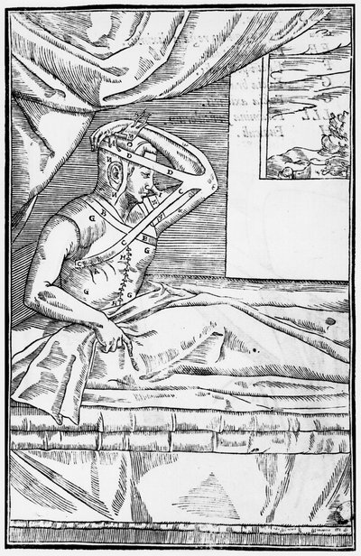 Cirugía reconstructiva en la nariz, ilustración de De curtorum chirurgia per insitionem por Gaspare Tagliacozzi (1545-99) Venecia, publicado en 1597 de Italian School