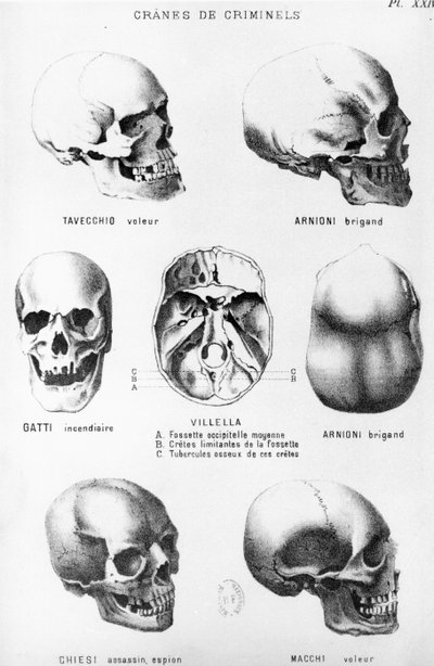 Cráneos de asesinos, de LHomme Criminel por Cesare Lombroso, publicado por Felix Alcan, 1887 de Italian School