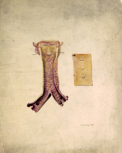 Estudio de tráquea de J. Counolly