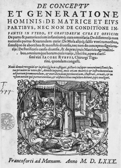 Escena de parto, -en “De Conceptu et generatione hominis...” por Jacques Rueff de Jacob Rueff