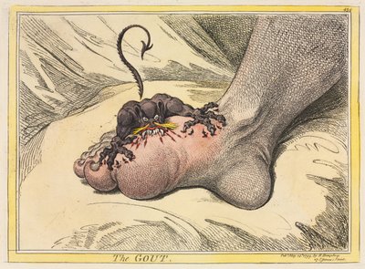 La gota, 1799 de James Gillray