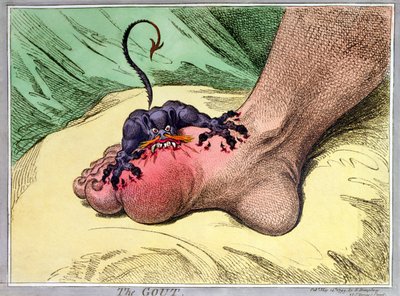 La gota, publicada por Hannah Humphrey en 1799 de James Gillray