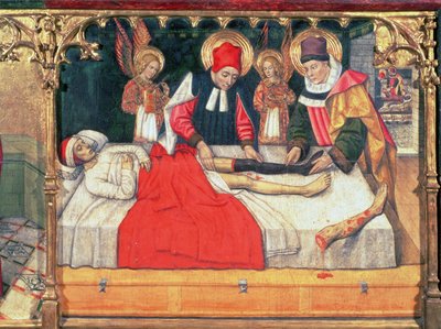 126-0035321 SS. Cosme y Damián injertan la pierna de un etíope en el muñón del diácono Justiniano; de Jaume Huguet