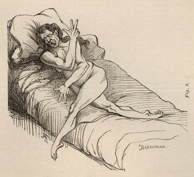 Epilepsia histérica, ataque, contorsiones, fig. 3 de 