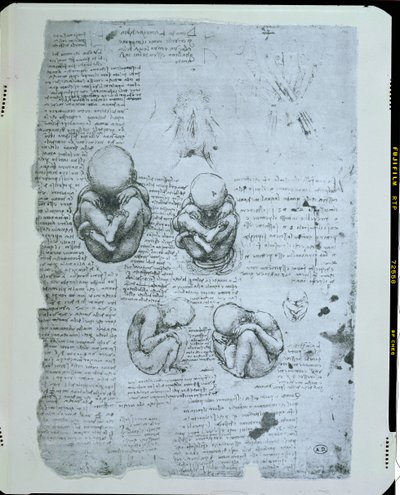 Cinco vistas de un feto en el útero, copia facsímil de Leonardo da Vinci