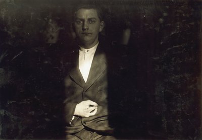 Frank Wiegel, de Brooklyn, herido tras trabajar 18 horas diarias a los 15 años, le amputaron dos dedos de la mano derecha, Nueva York de Lewis Wickes Hine