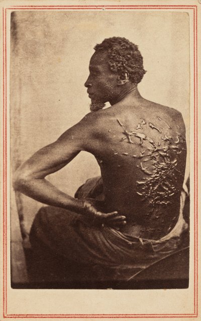 La espalda flagelada,c. 1863 (foto) de McPherson & Oliver