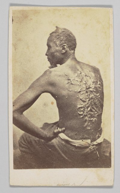 Gordon bajo inspección médica, 1863 de McPherson and Oliver