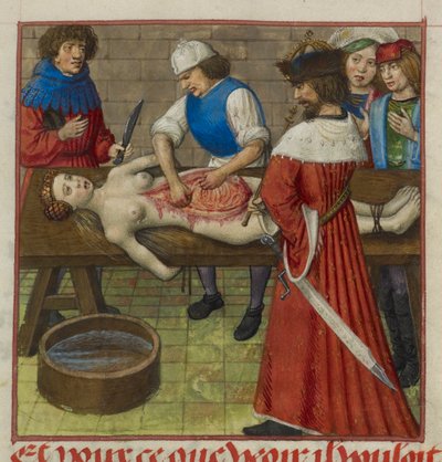 Harley 4425 f.59 Nero viendo cómo se diseca a su madre Agrippina, ilustración de 
