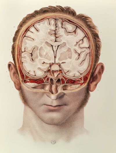 El cerebro, lámina de Traité Complet de l